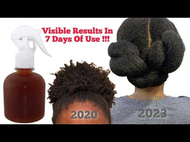 Your hair may become too thick to handle in JUST 2 WEEKS of using this hair tea 