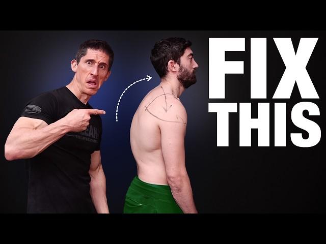 How to Fix Rounded Shoulders (FOREVER!)