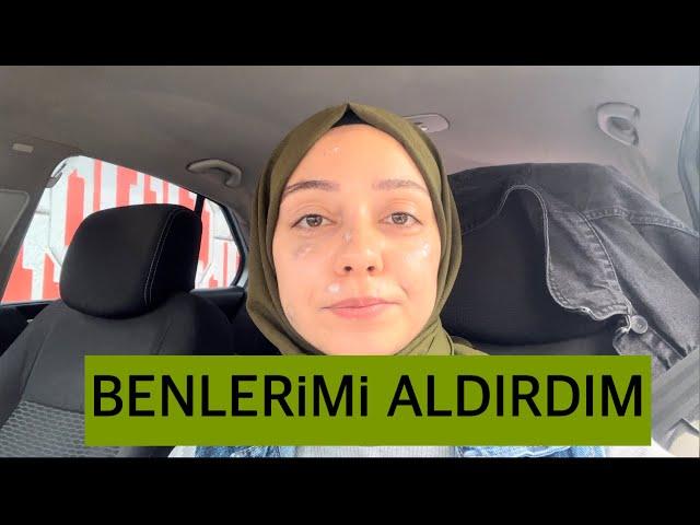 Benlerimi aldırdım | Vlog