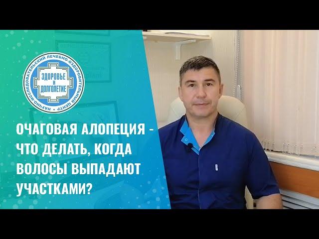  Очаговая алопеция   что делать, когда волосы выпадают участками?