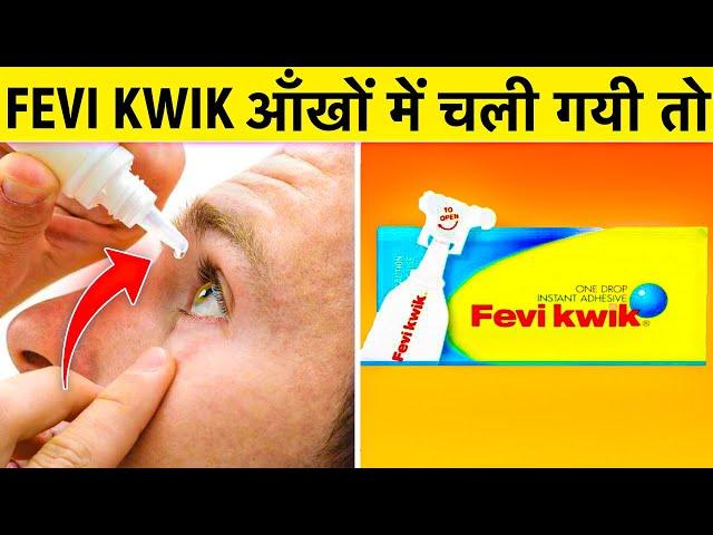 FeviKwik आंखों में चला जाए तो? | 18 Amazing Random Facts | Rewirs Facts