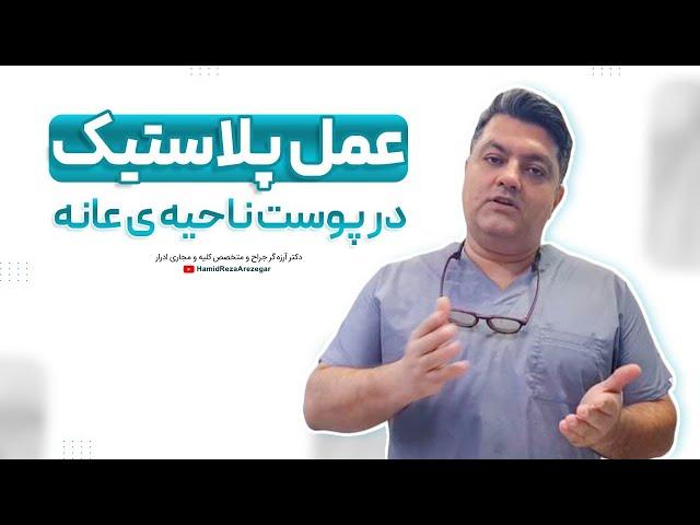 عمل پلاستیک در پوست ناحیه عانه