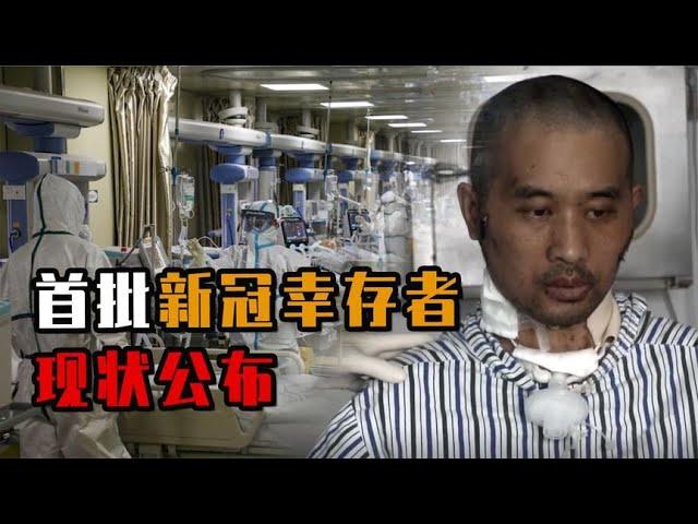 首批感染新冠幸存者怎么样？暴瘦四十斤，器官衰竭，生不如死！