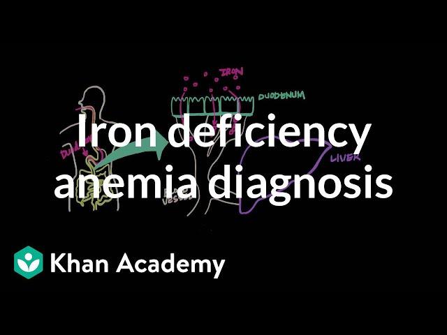 Iron deficency anemia diagnosis | Hematologic System Diseases | NCLEX-RN | Khan Academy