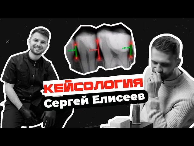 Сергей Елисеев - кейсология