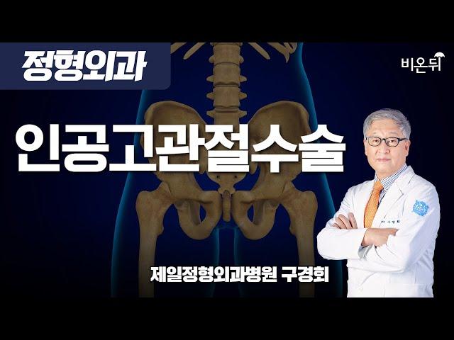 인공고관절수술 / 제일정형외과병원 구경회