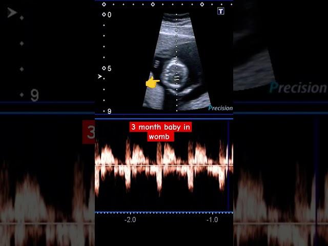 3 Month Baby in womb | fetal development in womb | #babyinwomb #baby #pregnencytips #pregnancy