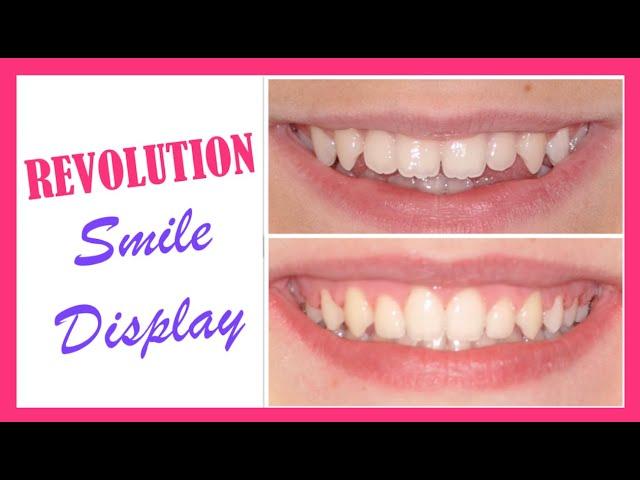 Open Bite Treatment: orthodontic differential diagnosis