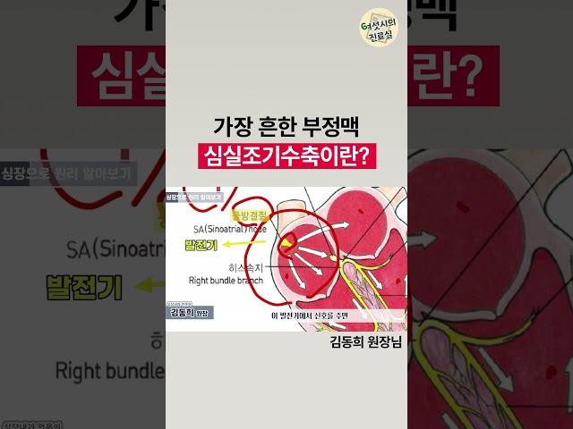 심장이 덜컹! 가장 흔한 부정맥, 심실조기수축이 발생하는 이유는?