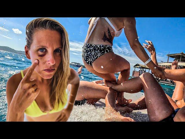 BLACK EYE!!  The girls get a little wild in Fiji!  - (Episode 282)