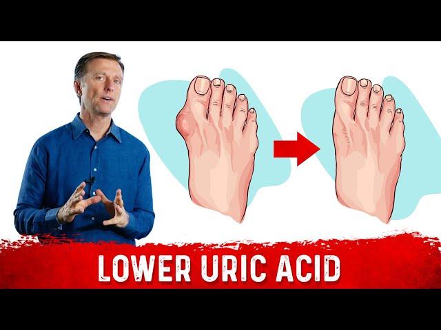 4 Ways  to Neutralize Uric Acid