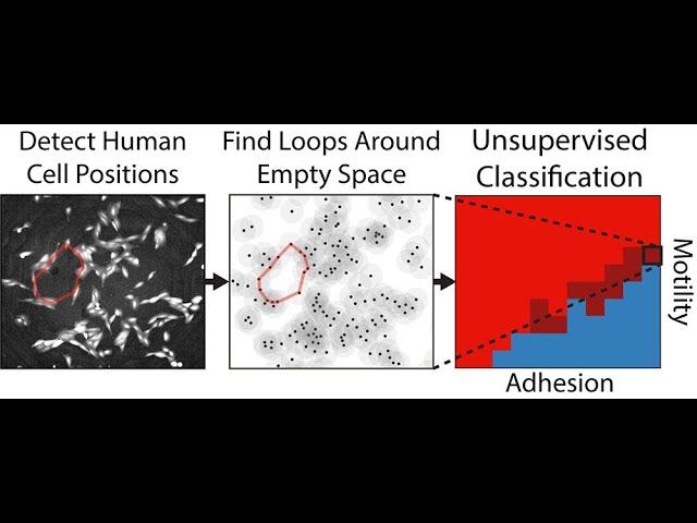 Ian Wong: Topological data analysis of collective cell migration