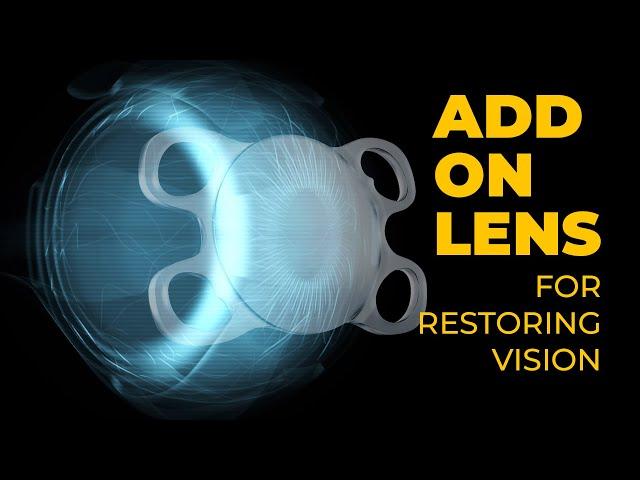 See Clearly Again: An Add-on Lens For Restoring Vision