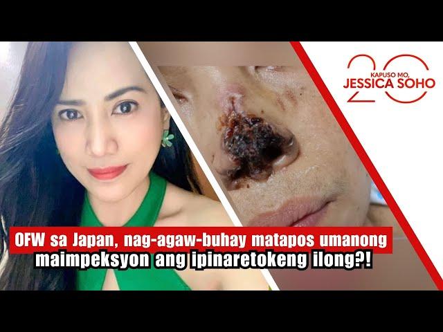 OFW sa Japan, nag-agaw-buhay matapos maimpeksyon ang ipinaretokeng ilong?! | Kapuso Mo, Jessica Soho