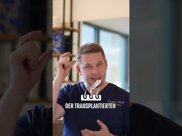 Wie viel kostet eine Haartransplantation in Deutschland?