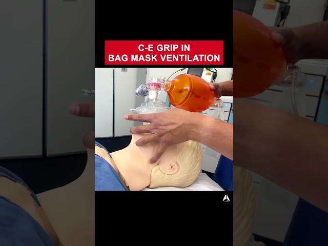 C-E Grip in Bag Mask Ventilation | #anesthesia #bagmaskventilation #airway