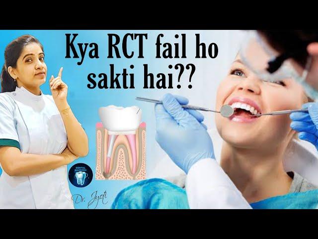 kya RCT fail ho sakti hai?? | dental maestro | Dr Jyoti Agarwal