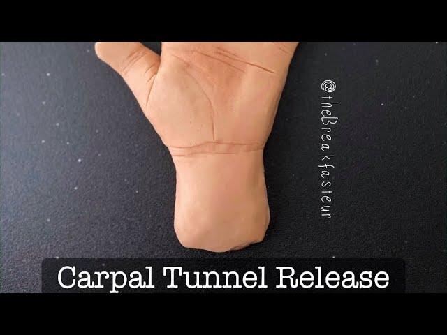 Playdough Surgery  - Carpal Tunnel Release