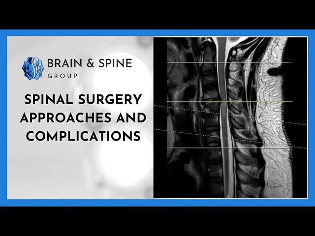 Spinal Surgery Approaches and Complications