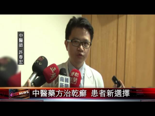 20150522 中醫藥方治乾癬 患者新選擇