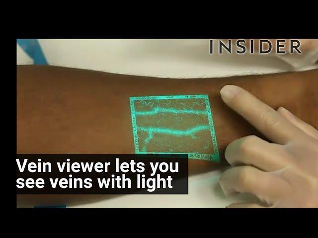 Vein Viewer