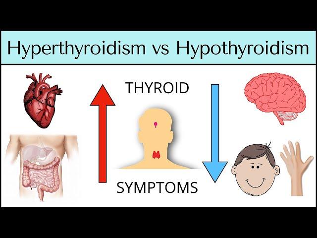 Hyperthyroidism vs Hypothyroidism: Symptoms MADE EASY [Thyroid Explained]