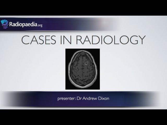 Cases in Radiology: Episode 1 (neuroradiology, CT, MRI)