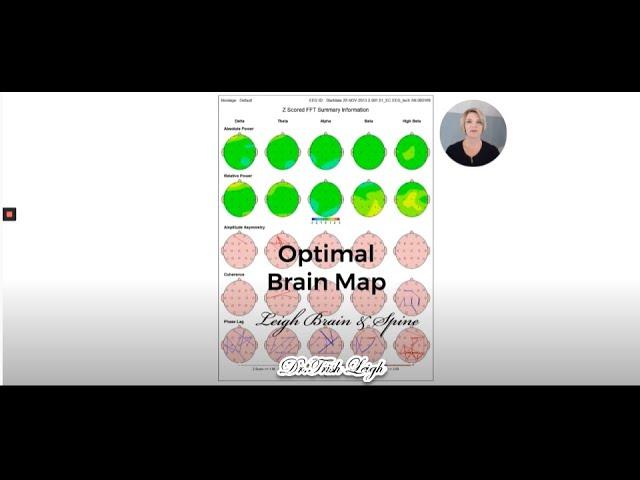 How to Interpret Your qEEG Brain Map.