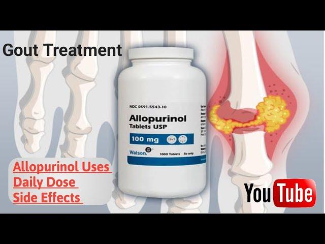 How to Use Allopurinol ??