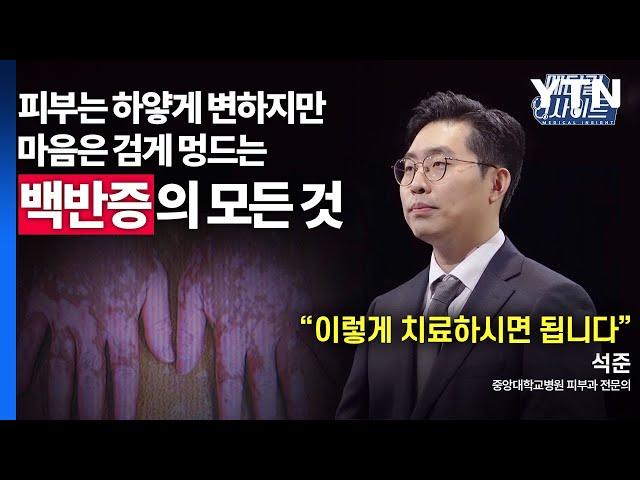 [메디컬 인사이트 63회] 피부과 전문의가 알려주는 '백반증'의 증상과 치료법 / YTN