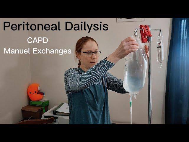 Peritoneal Dialysis (PD) Manual Exchanges: Step-by-Step Guide in 2023