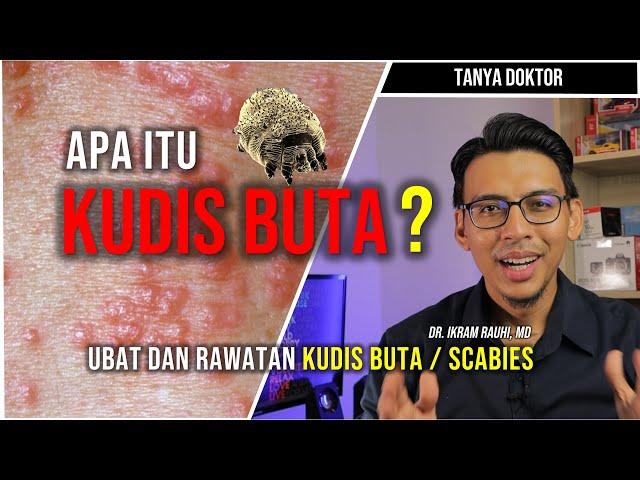 APA ITU KUDIS BUTA (SCABIES) ? Ubat dan Cara Merawat Kudis Buta