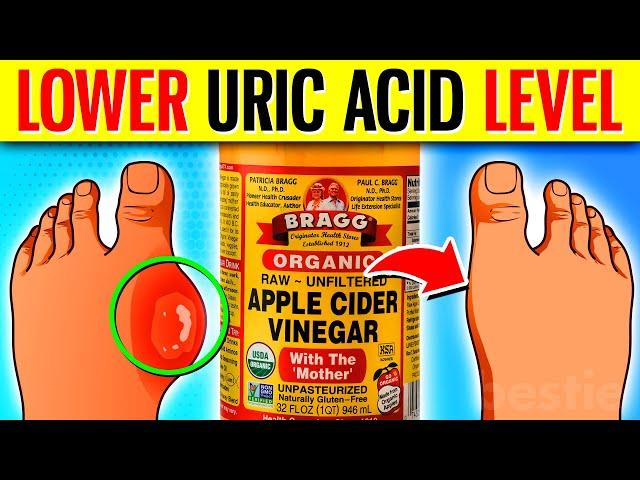 20 Foods That LOWER Your Uric Acid Levels