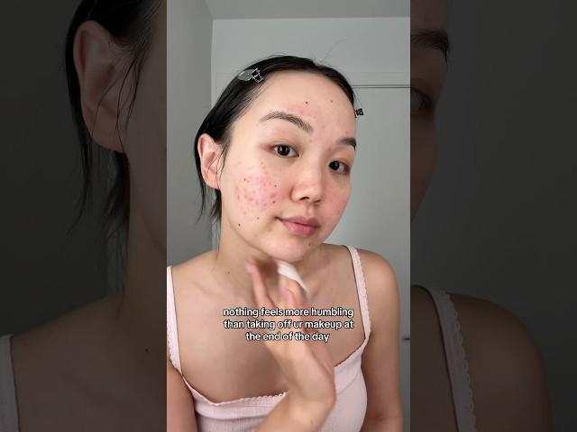 At least my skin can breathe again  #acne #relatable #clearskin #skincare