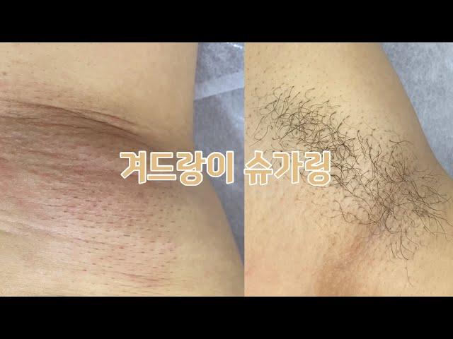 겨드랑이 푸쳐업 | 여름 겨드랑이어렵다..