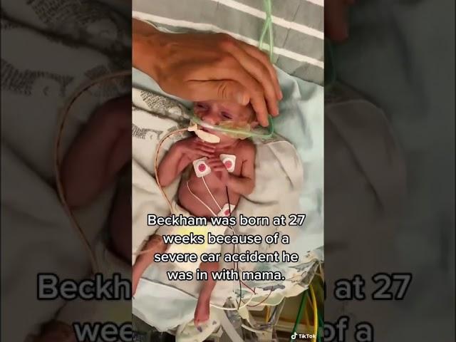 NICU WARRIOR BORN AT 27 WEEKS