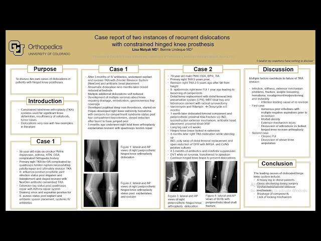 Case Report of Two Instances of Recurrent Dislocations Lisa Malyak 2