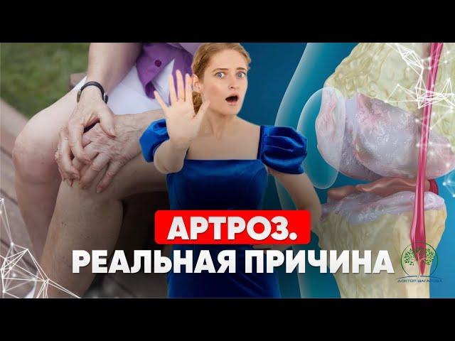 Как вылечить артроз без операции, уколов? Причины артроза