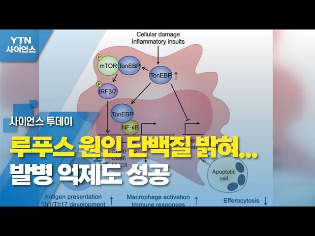 루푸스 원인 단백질 밝혀…발병 억제도 성공 / YTN 사이언스