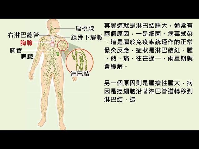 注意！腫大的淋巴結若有這三種病徵　快點就醫檢查