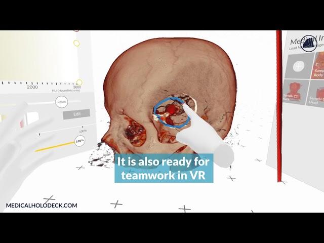 Medicalholodeck Major Update