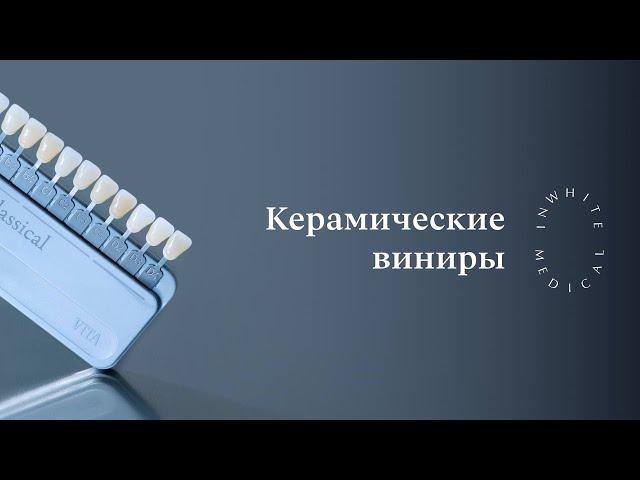 Керамические виниры | Диагностика и установка в Москве