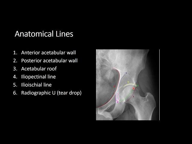 Pelvis & Hip  Part 1