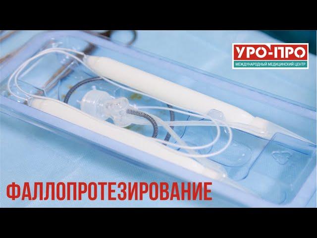 Фаллопротезирование: полное восстановление эректильной функции