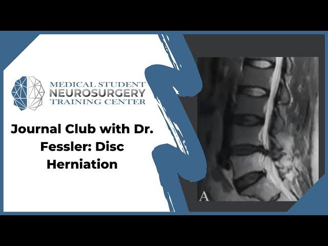 Journal Club with Dr. Fessler: Disc Herniation