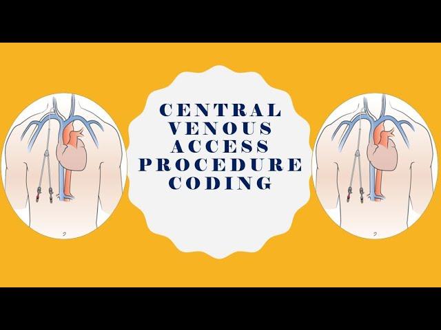 CARDIOVASCULAR SYSTEM CODING |CENTRAL VENOUS ACCESS PROCEDURES | MEDICLUX CODING TRAINING |