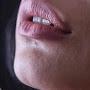 @zakhmidil125