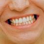 @keithwiththeteeth
