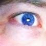 @1blueeye