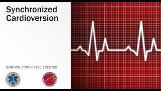 Synchronized Cardioversion